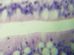 MISSING THUMBNAIL